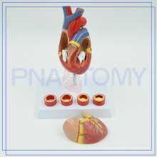 PNT-0401 Medical equipment heart anatomical model